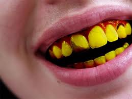 Teeth So Yellow